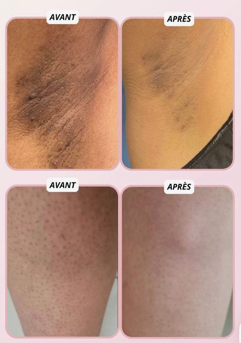 Gant Exfoliant Doux et Naturel