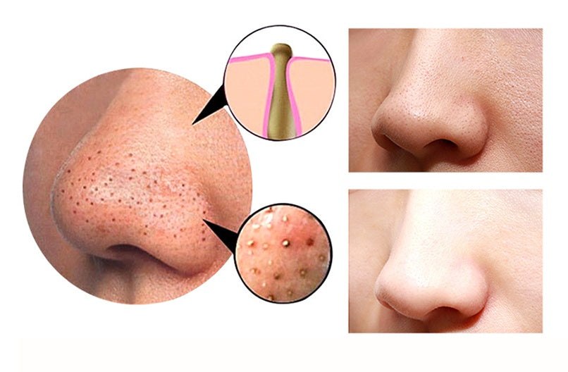 Appareil de soin du visage et du corps 4 en 1 – Nettoyage profond /skin care : massage revitalisant