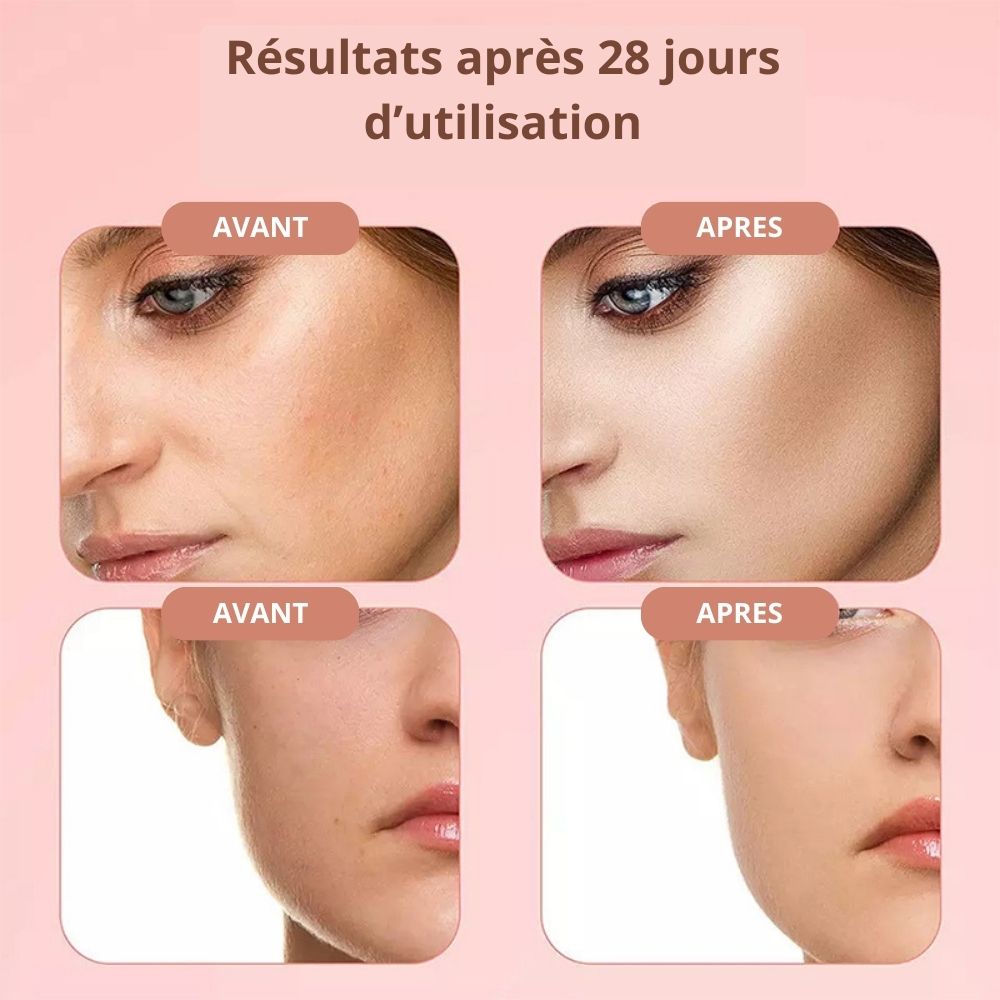 Sérum visage 4 en 1 – Vitamines C & E, Acide Hyaluronique et Nicotinamide