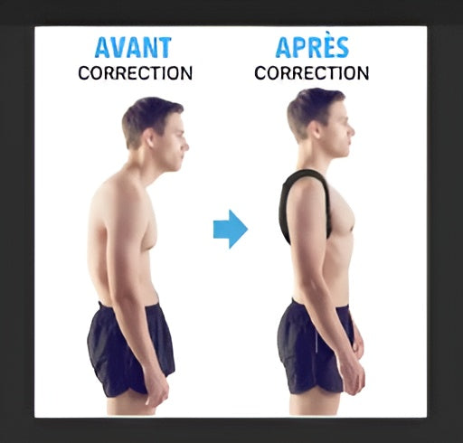 Correcteur de Posture Intelligent – Redresse-Dos Ergonomique pour Soulager Douleurs Cervicales et Mal de Dos